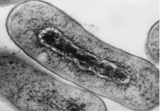 Electron micrograph cross section of Escherichia coli bacteria.