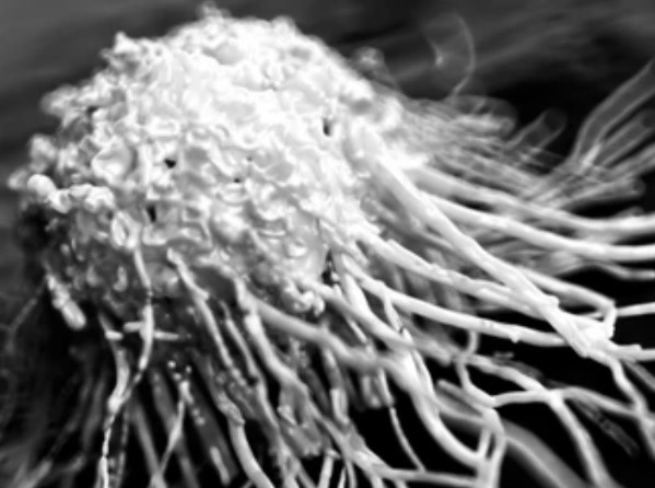 Cancer Cell Imaging Using the iEM Platform