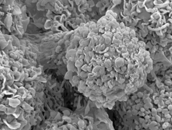 Scanning electron microscopy of single human cells