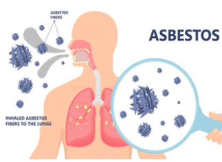 Asbestos breath.