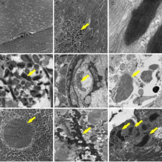 Fig1. Ultrastructural muscle component evaluation using transmission electron microscopy (TEM) (Cotta, A., et al, 2021).