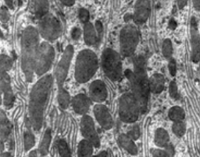 Transmission electron microscope (TEM) micrograph showing of a kidney convoluted tube cell.