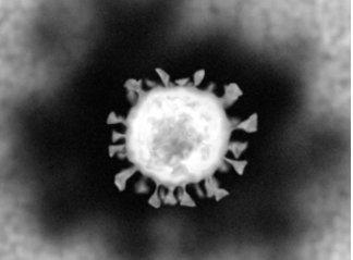 A single coronavirus particle as seen under a transmission electron microscope.